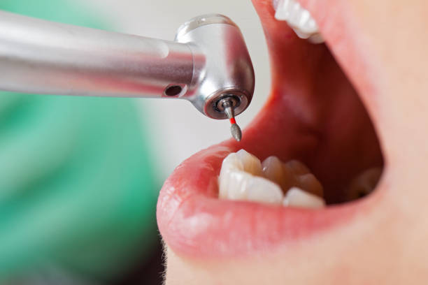 Best Pediatric Emergency Dentist in Minoa, NY